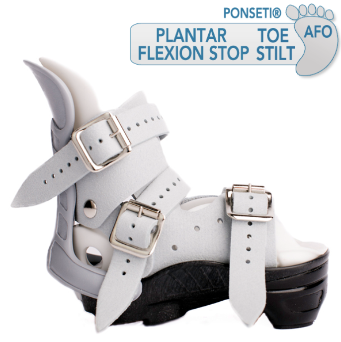 Clubfoot AFO PFS/TS MD Orthopaedics Clubfoot/Ponseti